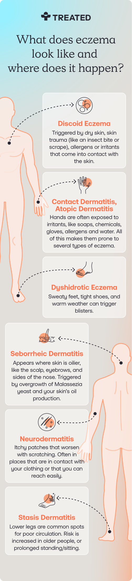 Infographic displaying what eczema looks like and where it occurs.