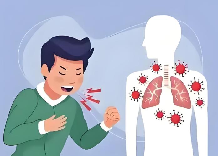 愛 克 痰 使用 方法