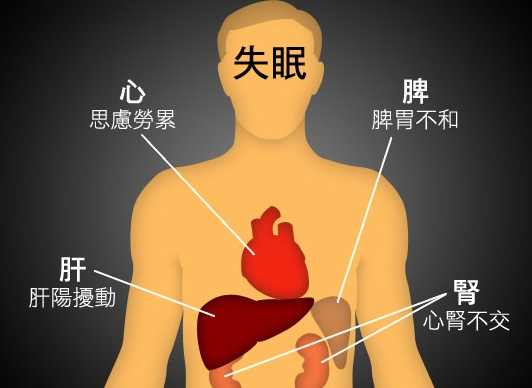 中醫失眠解決方法
