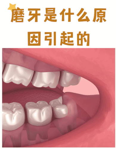 磨牙解決方法​