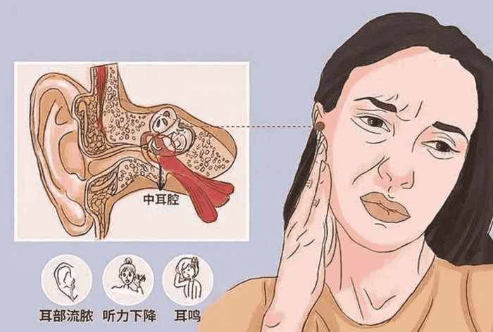 耳鳴会自己好嗎